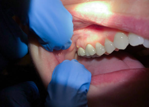 Best Emergency TMJ Treatment in Puget Island, WA