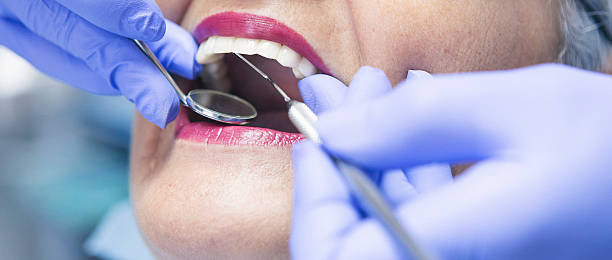 Best Emergency Dental Care for Broken or Chipped Teeth in Puget Island, WA